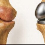 Garlic Honey: The “Sacred Remedy”