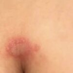 Collard Greens and Avocado for Knee Joint Health