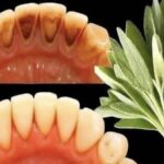 Natural Clove and Garlic Infused Balm